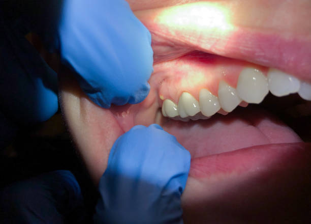 Best Cosmetic Emergency Dentistry in Colfax, WI