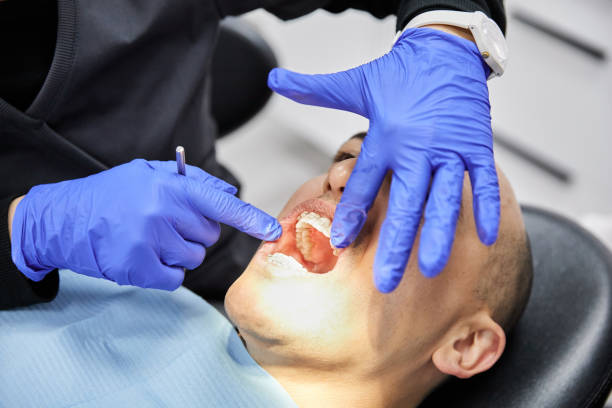 Best Emergency Dental Care for Broken or Chipped Teeth in Colfax, WI